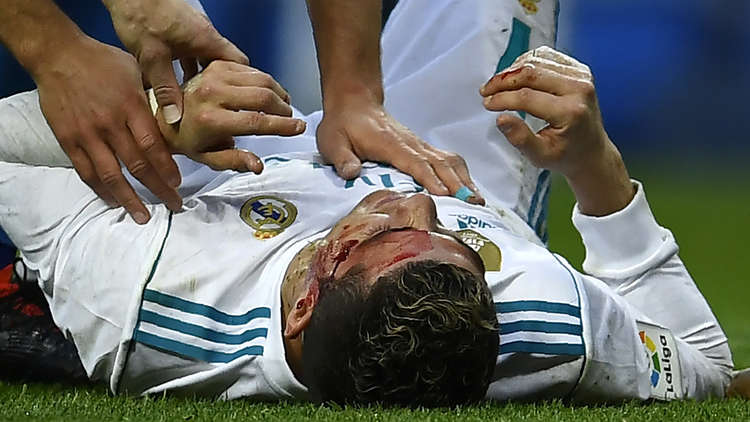 Ronaldo suffers nasty bloodied cut to the head & uses physio's mobile phone to assess the damage!