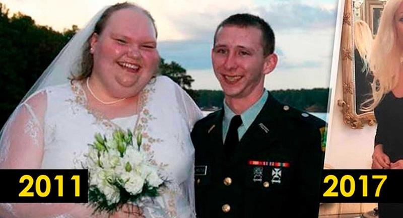 The 'Ugliest' Bride In The World Decided To Change & This Is What She Looks Like 6 Years Later