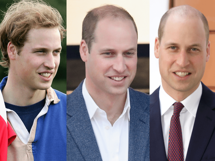 Prince William shaves off hair