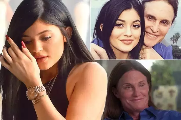 Kylie-Jenner-bruce-main