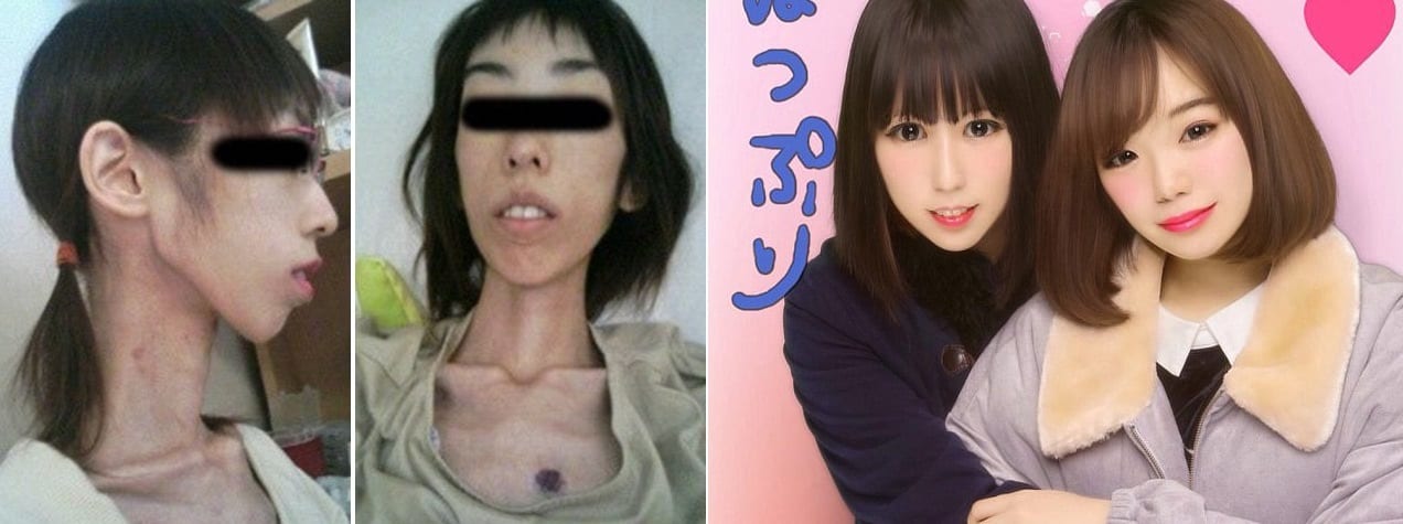 Japanese woman shares selfie from when she weighed 37lbs