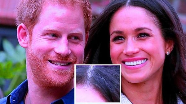 جدل دولي بسبب شعرة بيضاء ظهرت في رأس خطيبة الأمير هاري