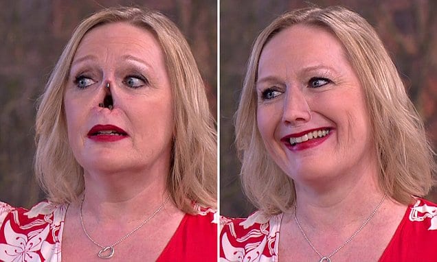 Jayne Hardman shows off her new prosthetic nose on 'This Morning'. Broadcast on ITV1 Featuring: Jayne Hardman When: 10 Apr 2018 Credit: Supplied by WENN **WENN does not claim any ownership including but not limited to Copyright, License in attached material. Fees charged by WENN are for WENN's services only, do not, nor are they intended to, convey to the user any ownership of Copyright, License in material. By publishing this material you expressly agree to indemnify, to hold WENN, its directors, shareholders, employees harmless from any loss, claims, damages, demands, expenses (including legal fees), any causes of action, allegation against WENN arising out of, connected in any way with publication of the material.**