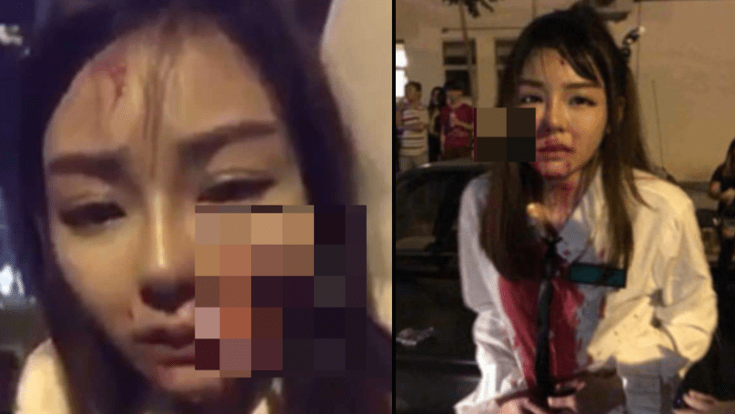 Teenager left with knife stuck in her face after robbed in Malaysia