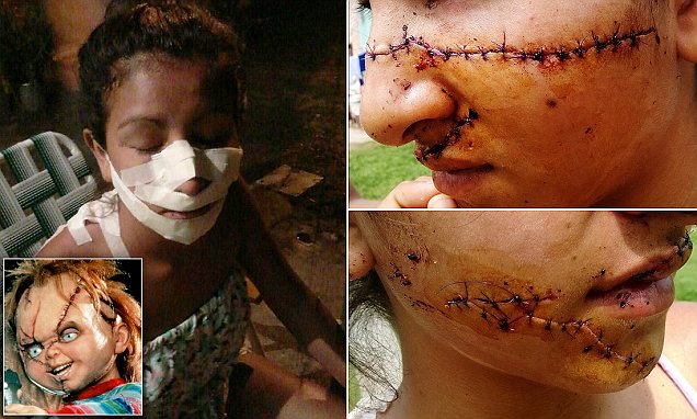 Pretty Argentinian teenage girl Julia Alvarez left disfigured after knife attack by two jealous girls
