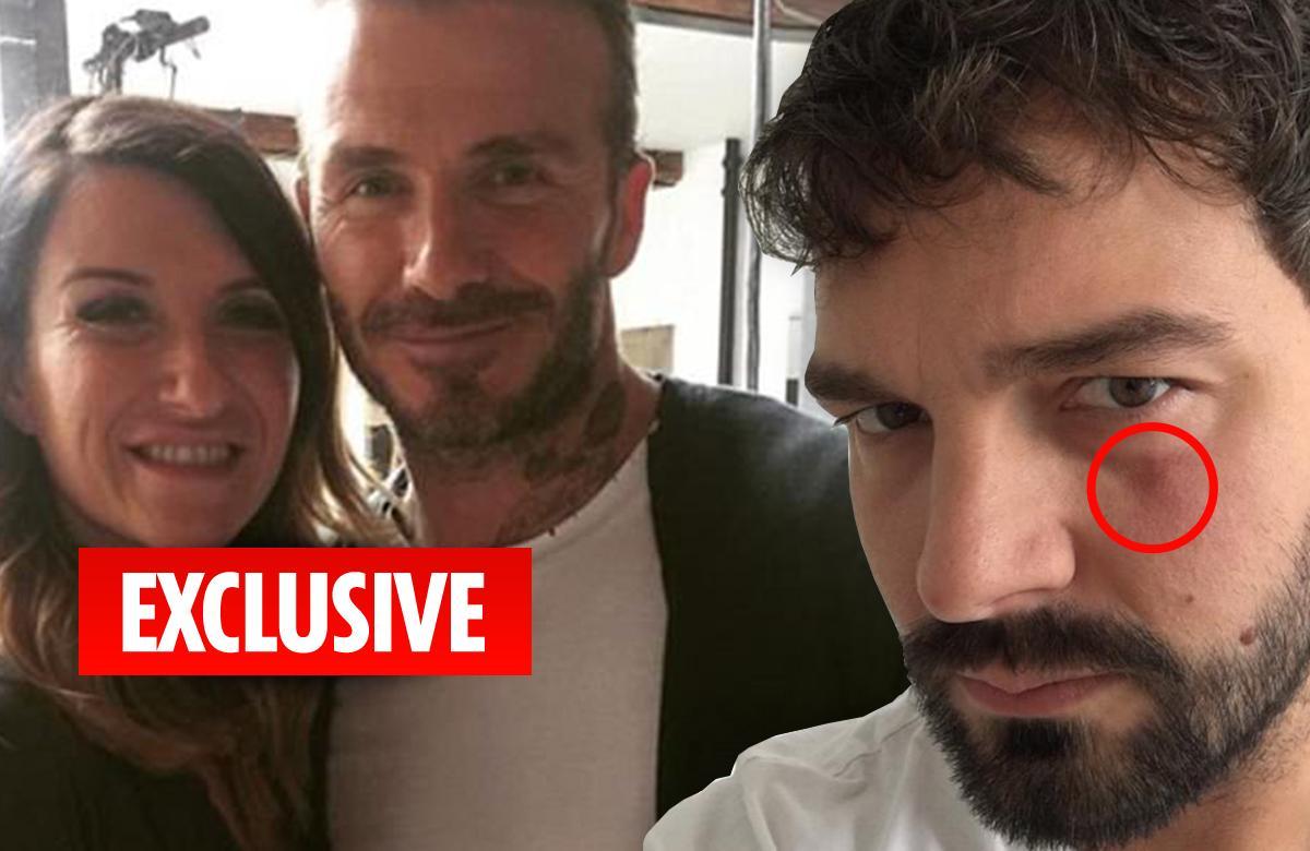David Beckham’s sister Joanne quizzed by cops over ‘assault on ex’ with a TV remote control