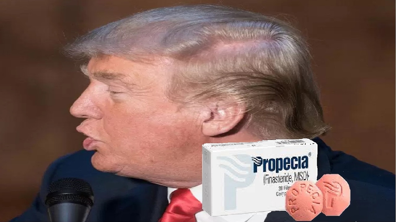 Donald Trump’s favorite drug for Hair Loss
