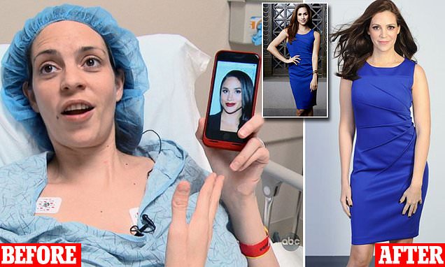 Meghan Markle wannabe mum-of-3 spends £19k on plastic surgery to look like idol
