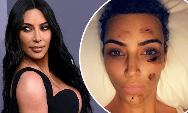 Kim Kardashian reveals she's drinking celery juice EVERY day to help her psoriasis