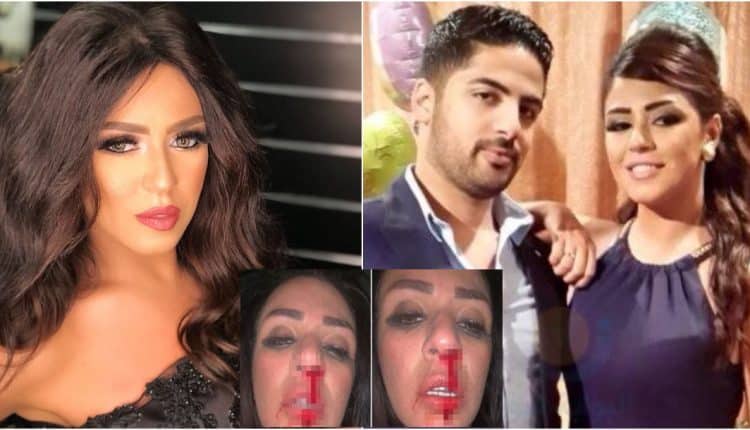 شاهدوا تفاصيل مثيرة ومفاجئة لزوج المطربة المصرية شاهيناز يرد على رواية اعتدائه عليها