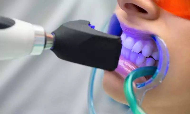 whitening theeth