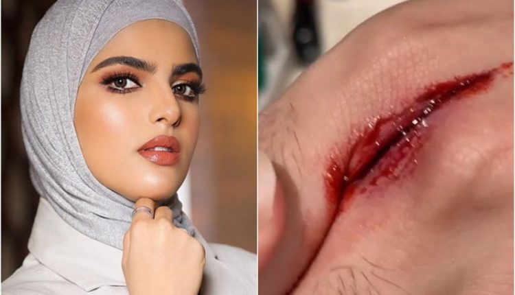 سارة الودعاني تتسبب في جرح عميق لزوجها وتوثقه بفيديو