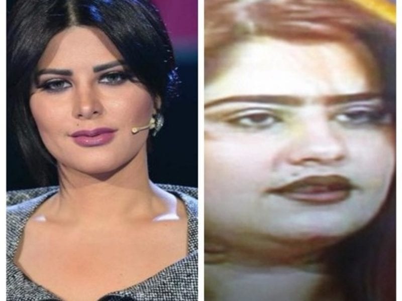 الفنانة "شمس الكويتية" قبل وبعد التجميل