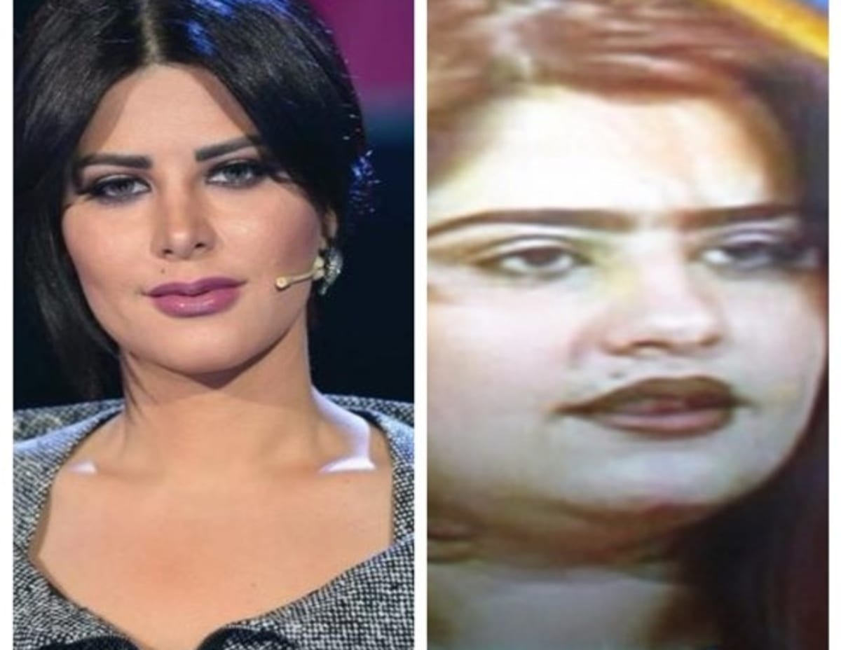 الفنانة "شمس الكويتية" قبل وبعد التجميل