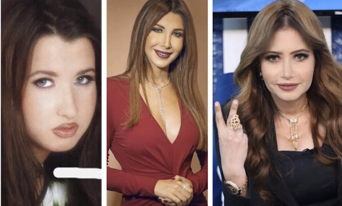 نانسي قبل عملية التجميل