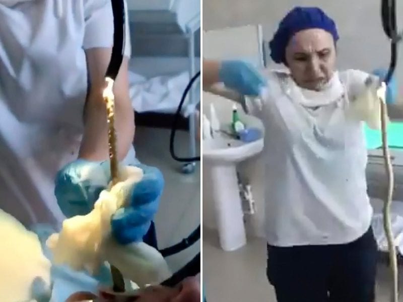 Horrifying moment a 4ft SNAKE is pulled from a Russian woman's throat after it crawled into her mouth while she slept