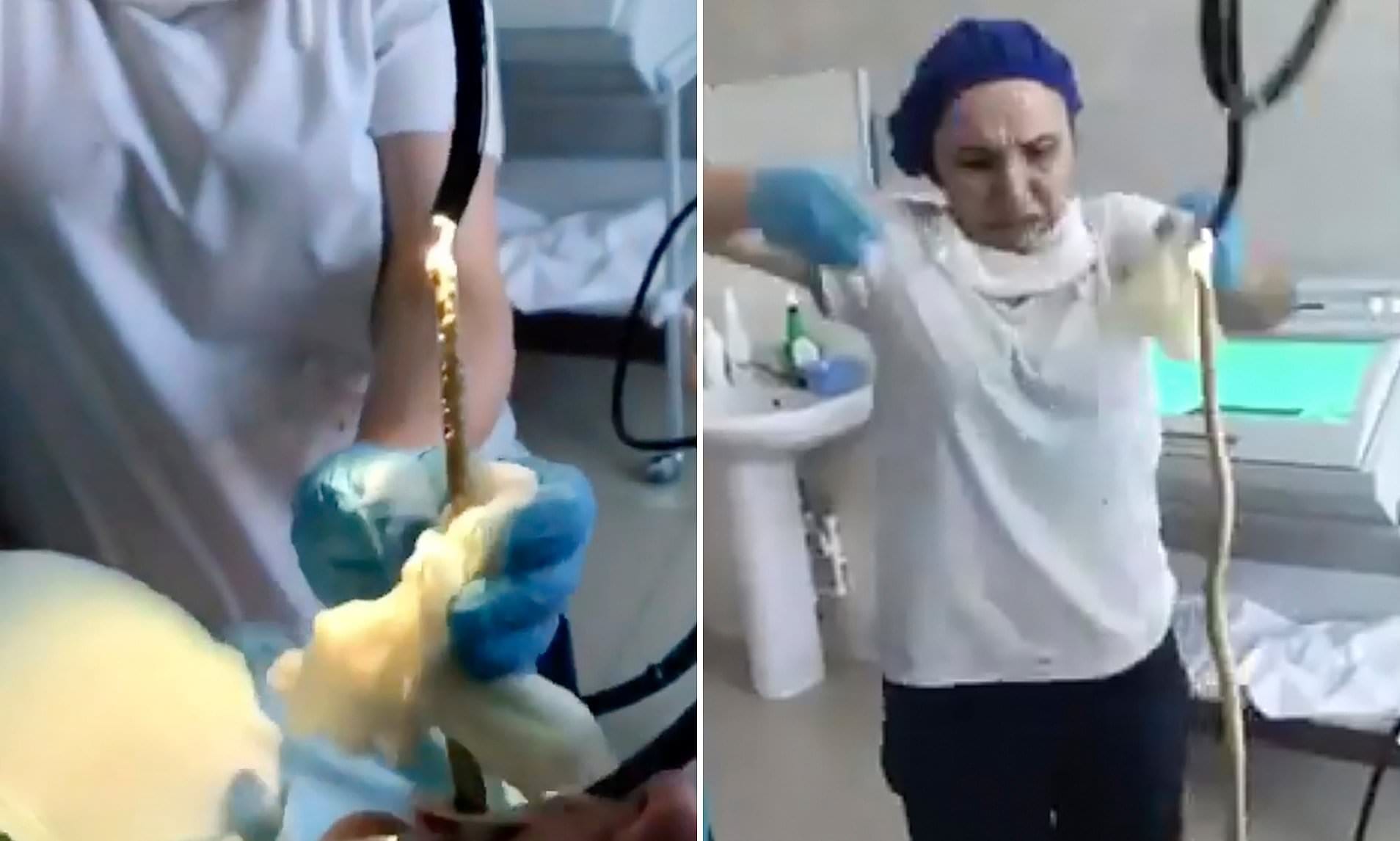 Horrifying moment a 4ft SNAKE is pulled from a Russian woman's throat after it crawled into her mouth while she slept