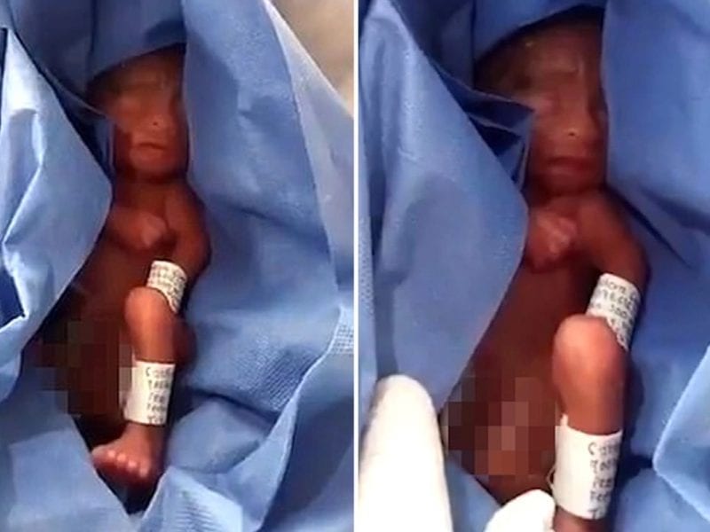 Miracle moment premature baby born 'dead' at 2