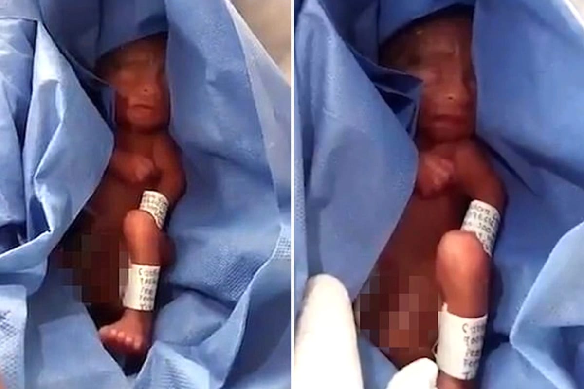 Miracle moment premature baby born 'dead' at 2